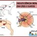 Doença renal crônica necessita de atenção
