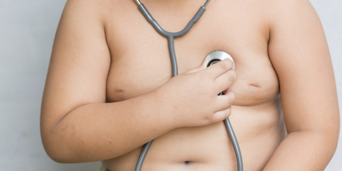 Obesidade infantil e suas consequências para a saúde