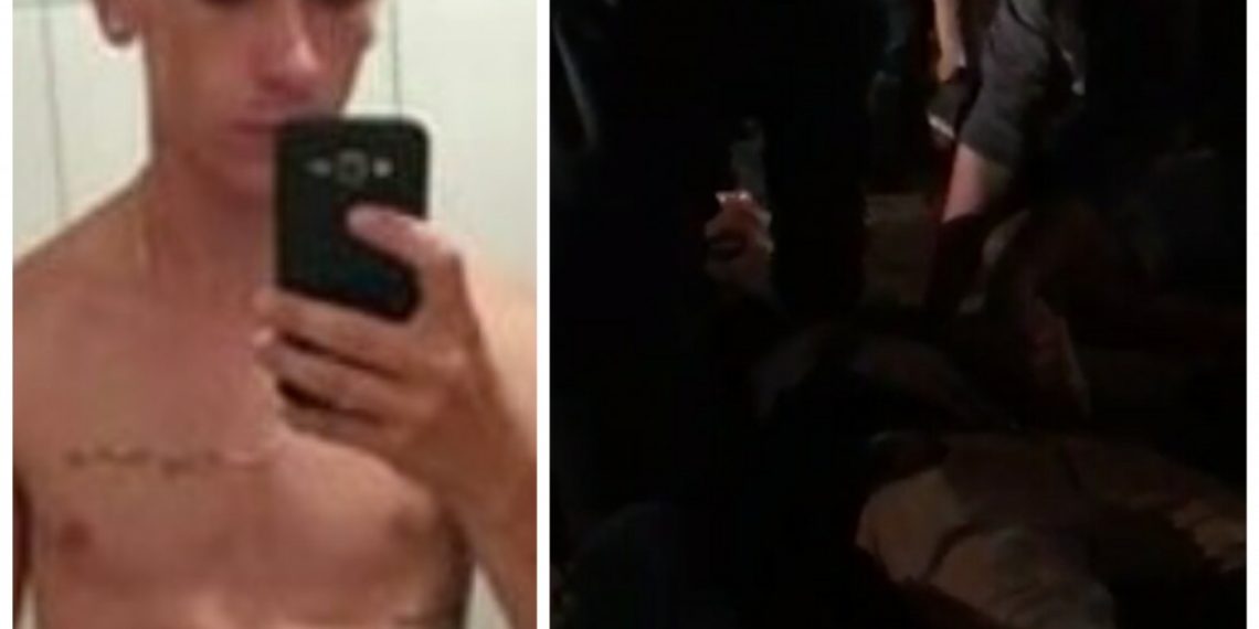 Jovem sofre acidente em Parobé e tem parte da perna amputada