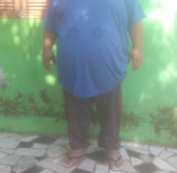 Há 4 anos na espera por cirurgia bariátrica, Ereni Camargo de Souza corre risco devido a sobrepeso