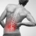 Prática de Pilates é um excelente aliado na prevenção e no tratamento de dor lombar, por Gabriela Plentz Stein