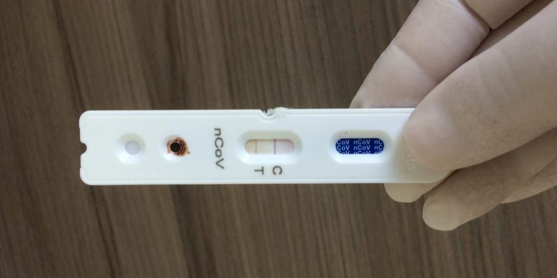 Anvisa aprova testes rápidos para Covid-19 em farmácias
