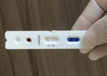 Anvisa aprova testes rápidos para Covid-19 em farmácias