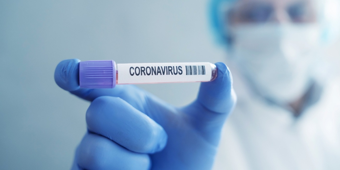 Quatro cidades da região já somam mais de 1,6 mil  testes de Covid-19