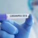 Quatro cidades da região já somam mais de 1,6 mil  testes de Covid-19