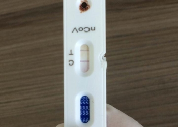 Sapiranga adquire novos testes para identificar casos de Covid-19