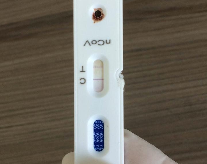 Sapiranga adquire novos testes para identificar casos de Covid-19