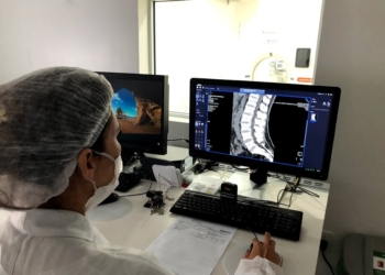 Mais de 1.400 tomografias e 7 mil exames de raio-x em quatro meses em Campo Bom