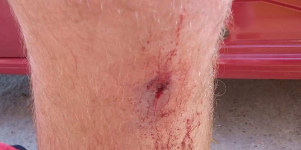Atleta é baleado na perna após confusão em jogo de futebol em Campo Bom