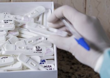 Mais 28,2 milhões de testes rápidos para Covid-19 serão distribuídos pelo Ministério da Saúde ainda em janeiro