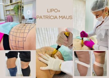 Guia Saúde & Beleza 2024: Descubra a sua melhor versão com o método exclusivo Lipo+, desenvolvido pela Patrícia Maus
