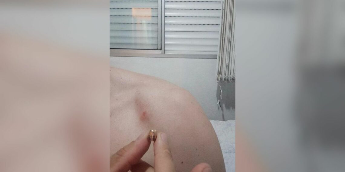 Nada de fogos de artifício! Morador da região é atingido por bala perdida
