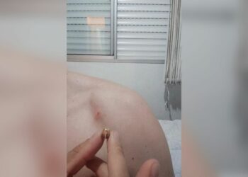 Nada de fogos de artifício! Morador da região é atingido por bala perdida