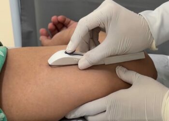 Dois Irmãos disponibiliza Implanon gratuito para 120 mulheres desde 2024